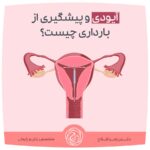 آی‌یودی چیست و چگونه از بارداری پیشگیری می‌کند؟