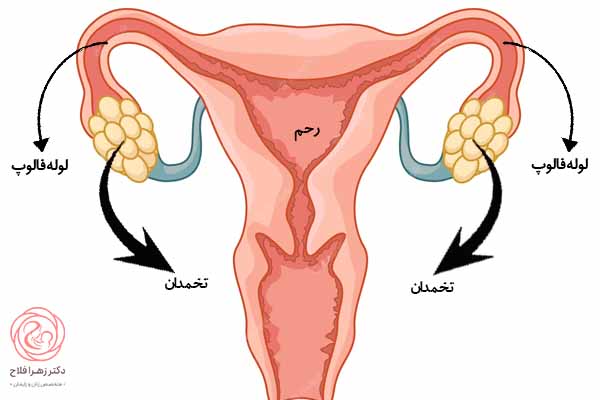 رحم و تخمدان